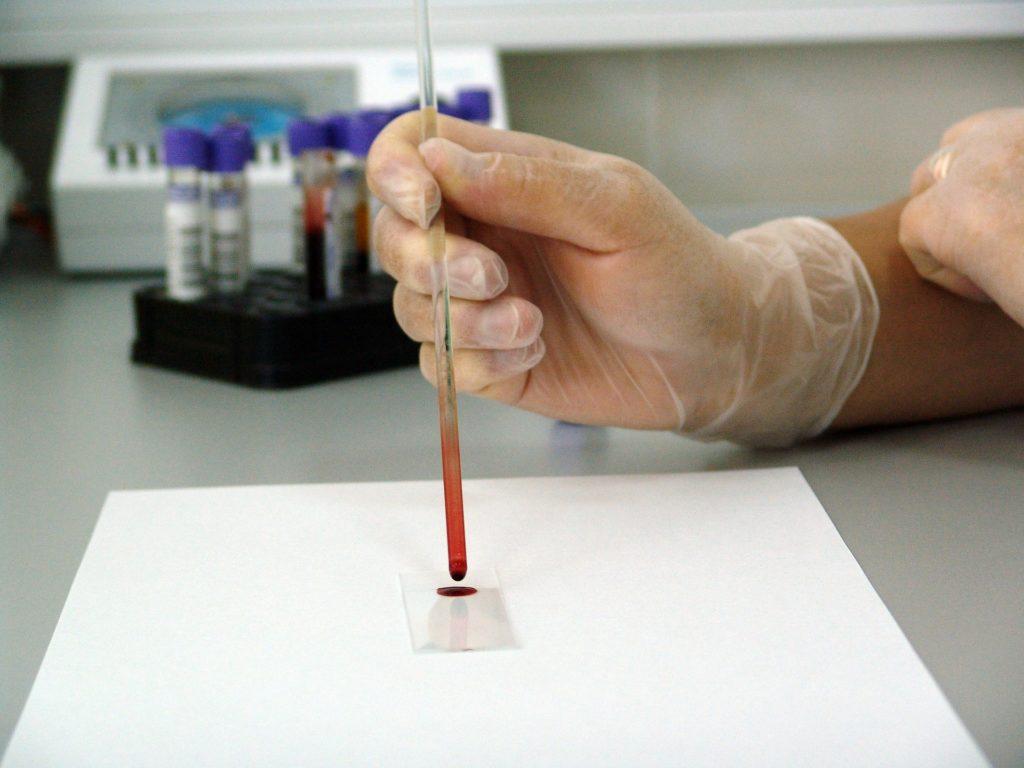 Анализ крови на микроэлементы